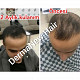 Dermanew hair saç serumu 32 AZN Tut.az Бесплатные Объявления в Баку, Азербайджане