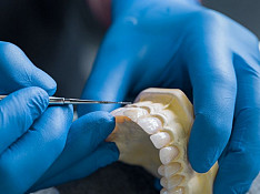 Diş texniki ( protez) kursları Bakı