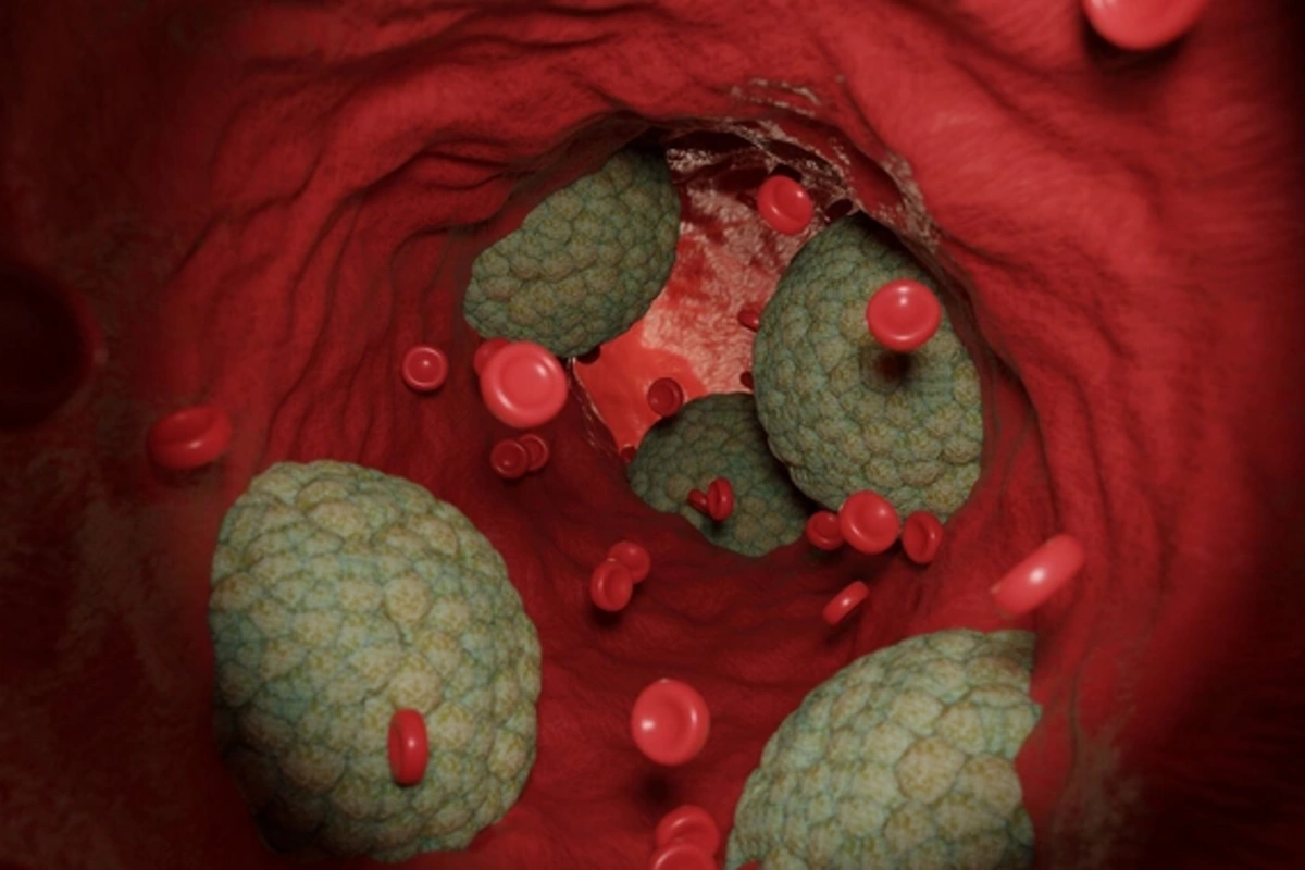 Unexpected factor increasing risk of early death revealed## Conversation