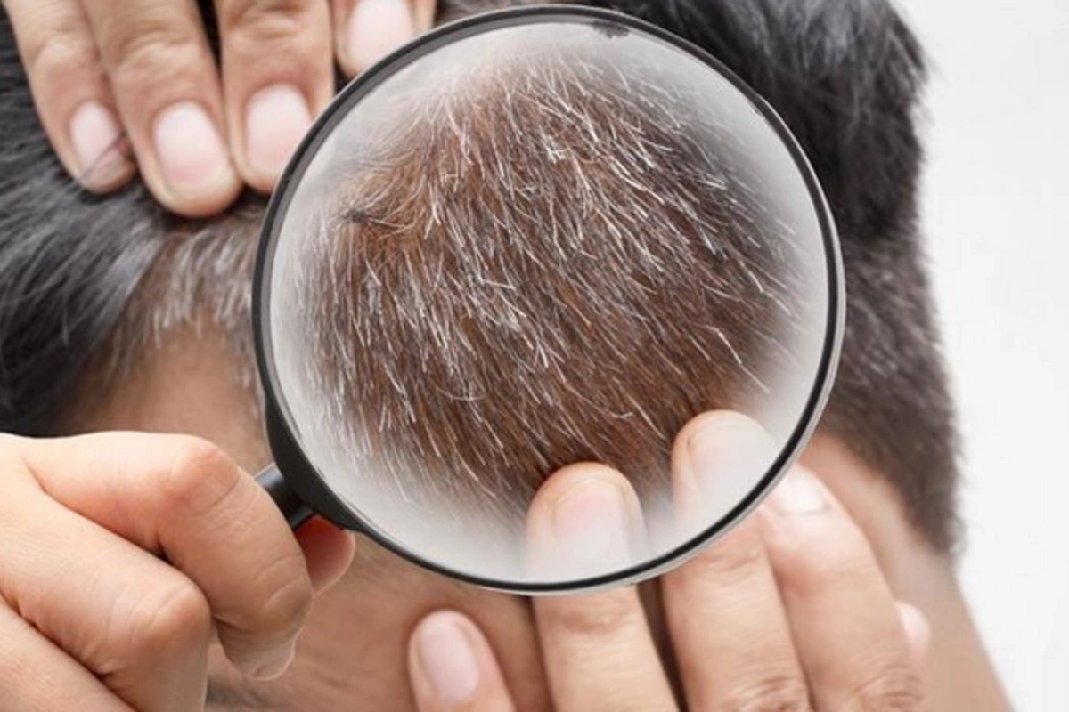 Why gray hair appears early: shocking facts you should know