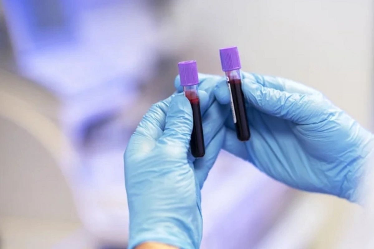 Развенчан распространенный миф о результатах общего анализа крови