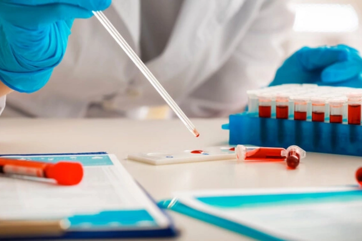 Раскрыт фактор, ускоряющий старение мужчин среднего возраста