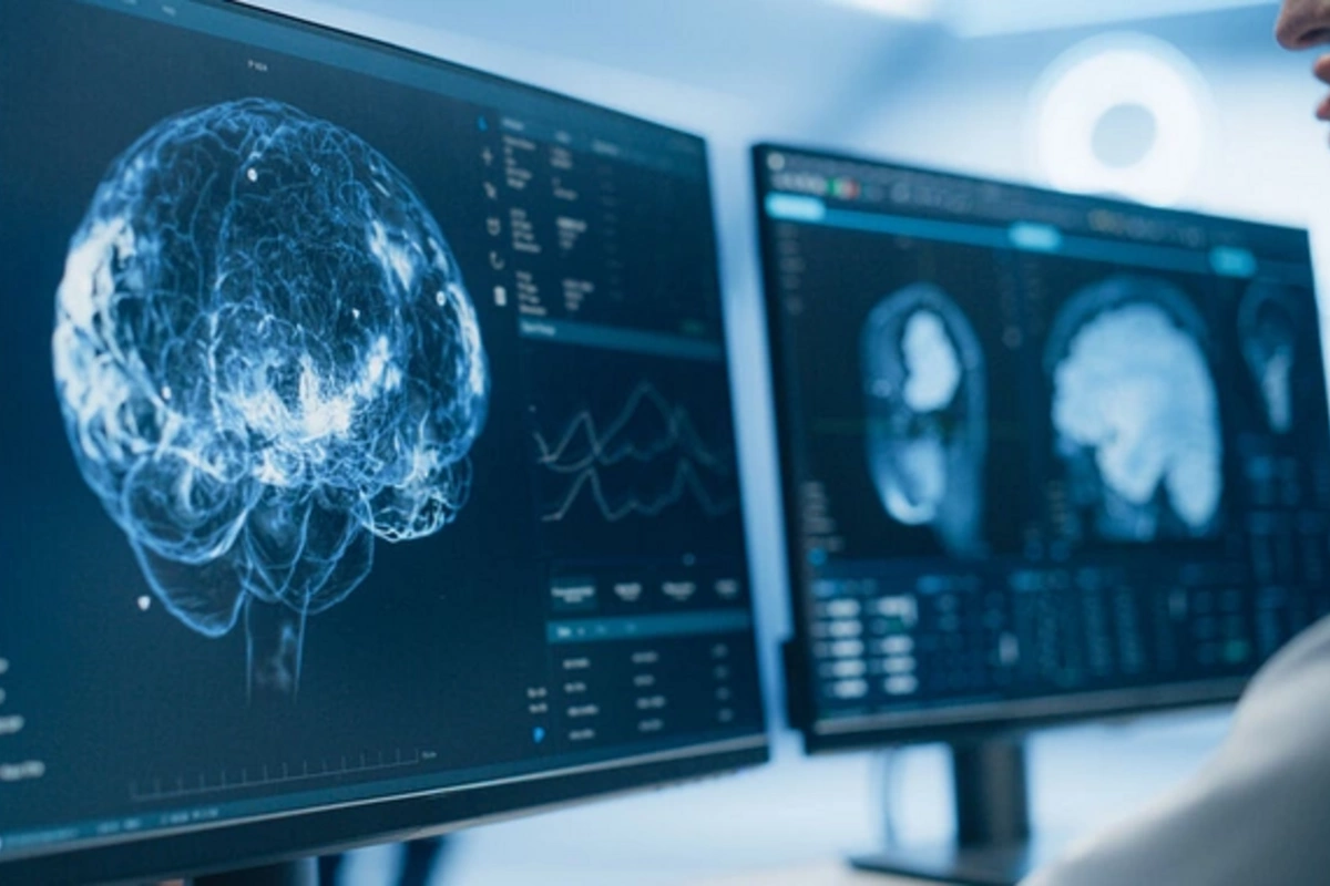 Scientists: Excessive TV watching leads to brain shrinkage
