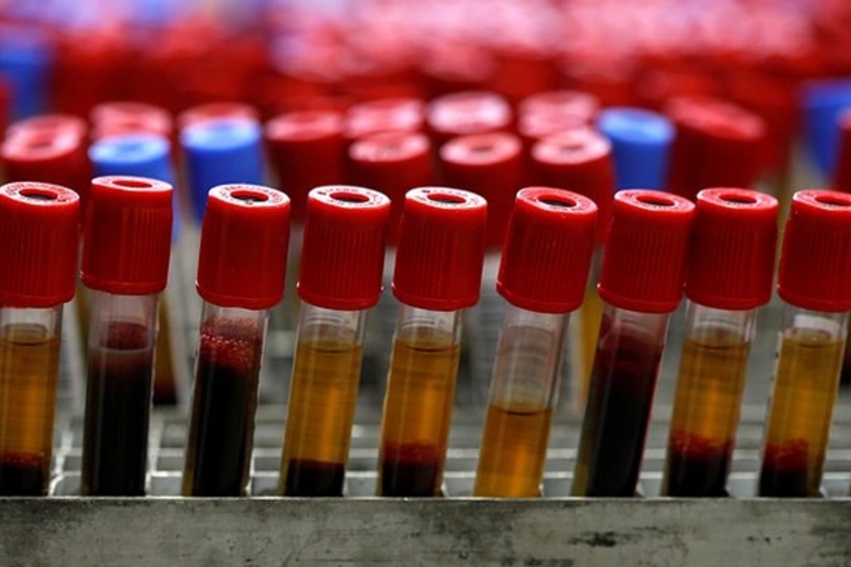 Обнаружен метод точного прогнозирования риска преждевременной смерти