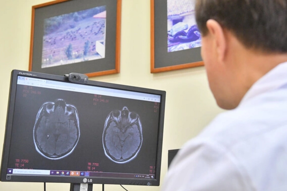 Раскрыта скрытая причина редкого детского инсульта