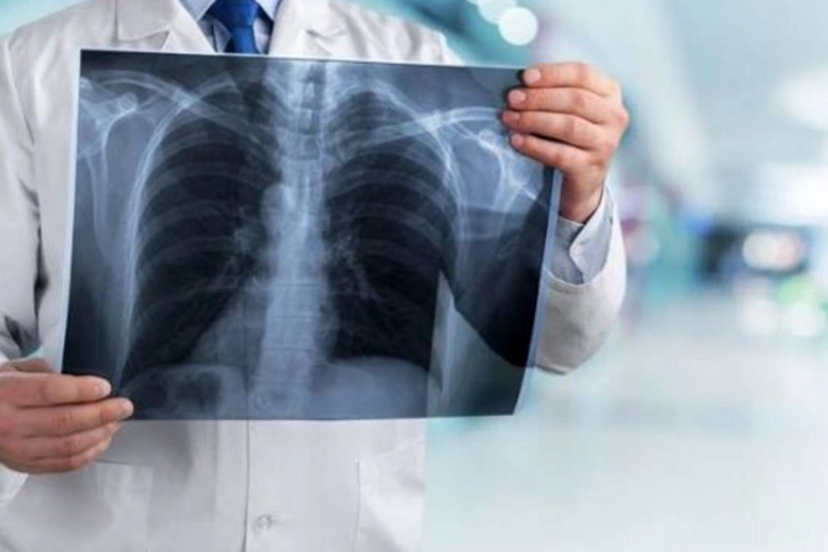 Doctor warned about the hidden danger of lung diseases
