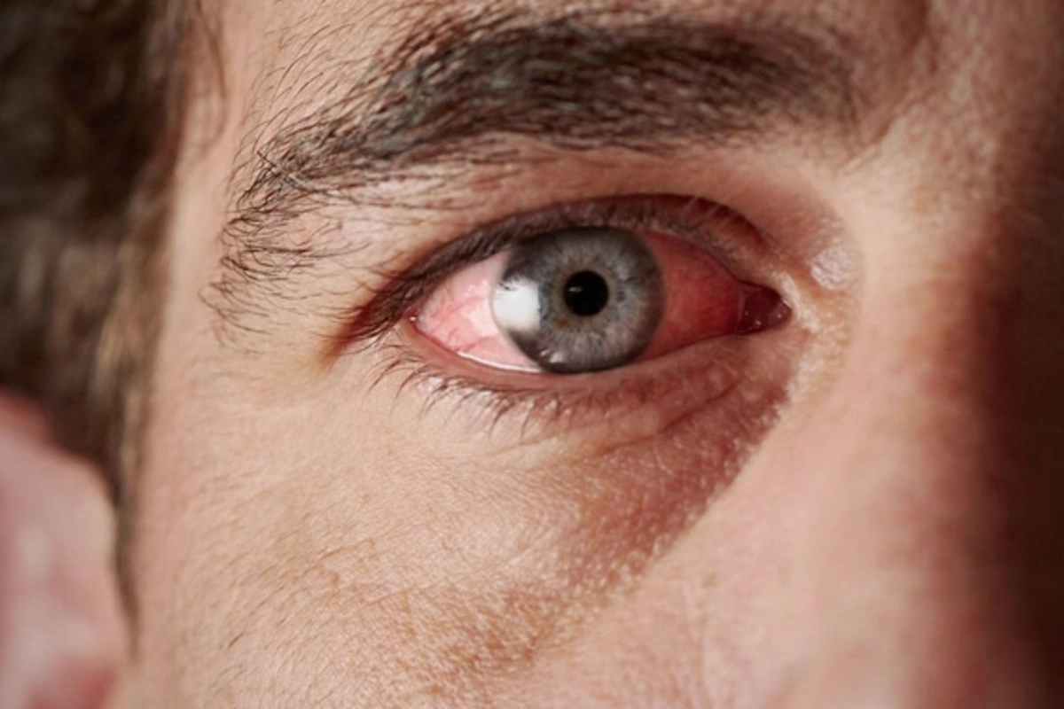 How to recognize health problems by looking at the eyes?