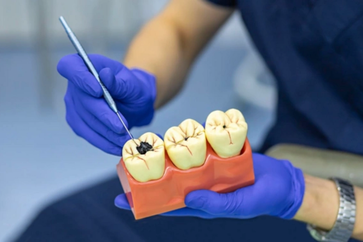 An amazing method for fighting cavities has been discovered