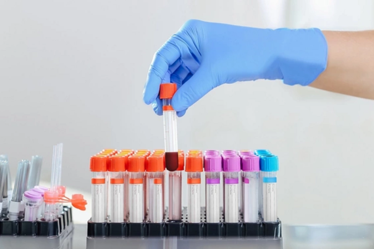 Five Tests After 35: Doctor Named the Key Ones