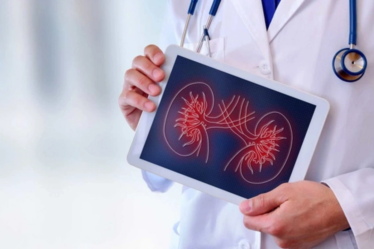 Ученые признали ошибку: камни в почках устроены иначе