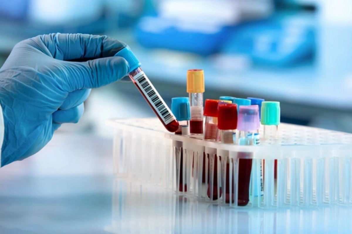 Революционный метод: рак лёгких можно выявить по одной клетке