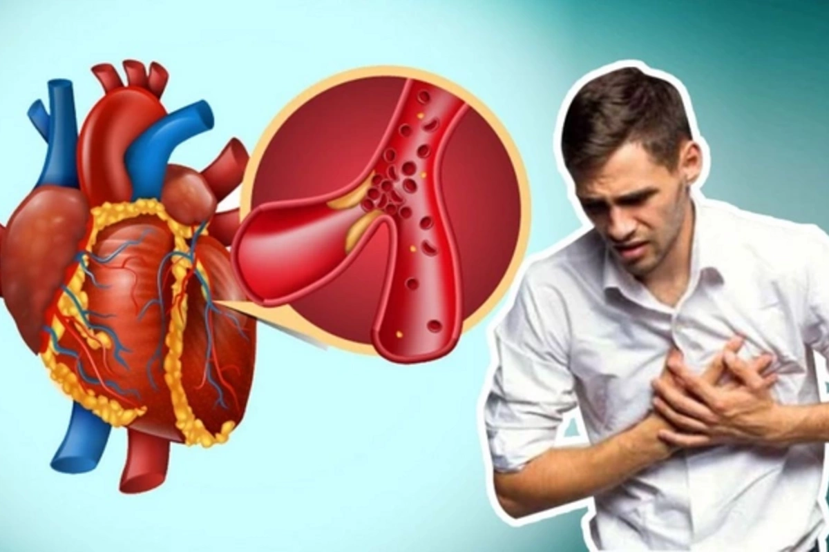 Мужчинам объяснили причины повышенного риска остановки сердцаСпециалисты раскрыли, почему представители сильного пола подвержены большей опасности внезапной сердечной недостаточности. Новое исследование проливает свет на факторы, которые делают мужчин бо