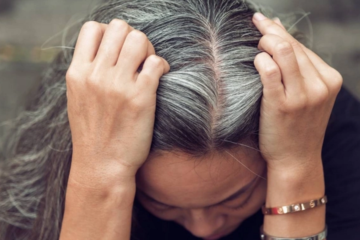 Раскрыты основные причины ранней седины
