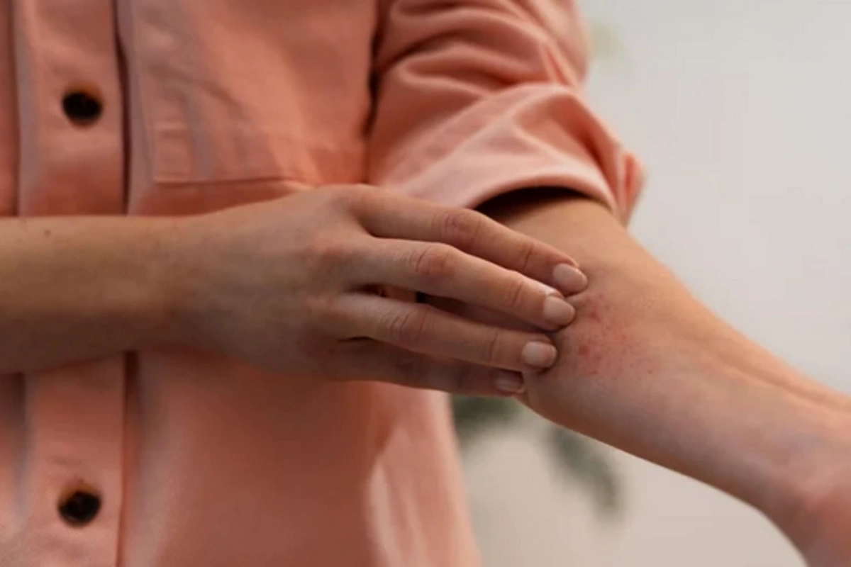 Itching could be a sign of a serious disease - scientists warn