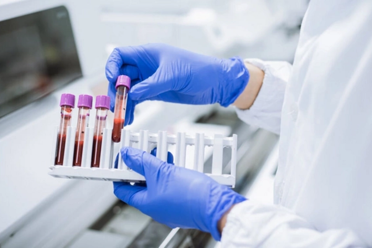 Учёные: риск рака крови на треть ниже у некоторых людей