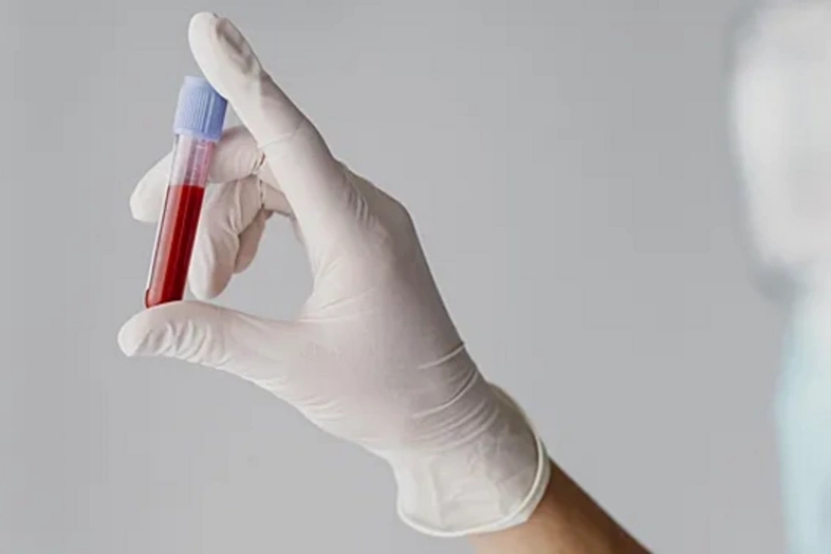 Just one test will tell you about the condition of your thyroid after 50