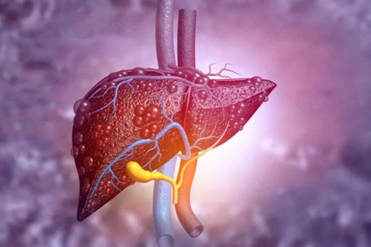 Popular drink named natural liver savior