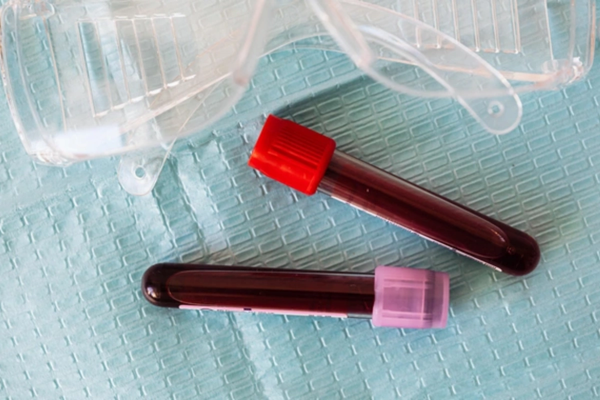 Blood test that helps predict heart attack