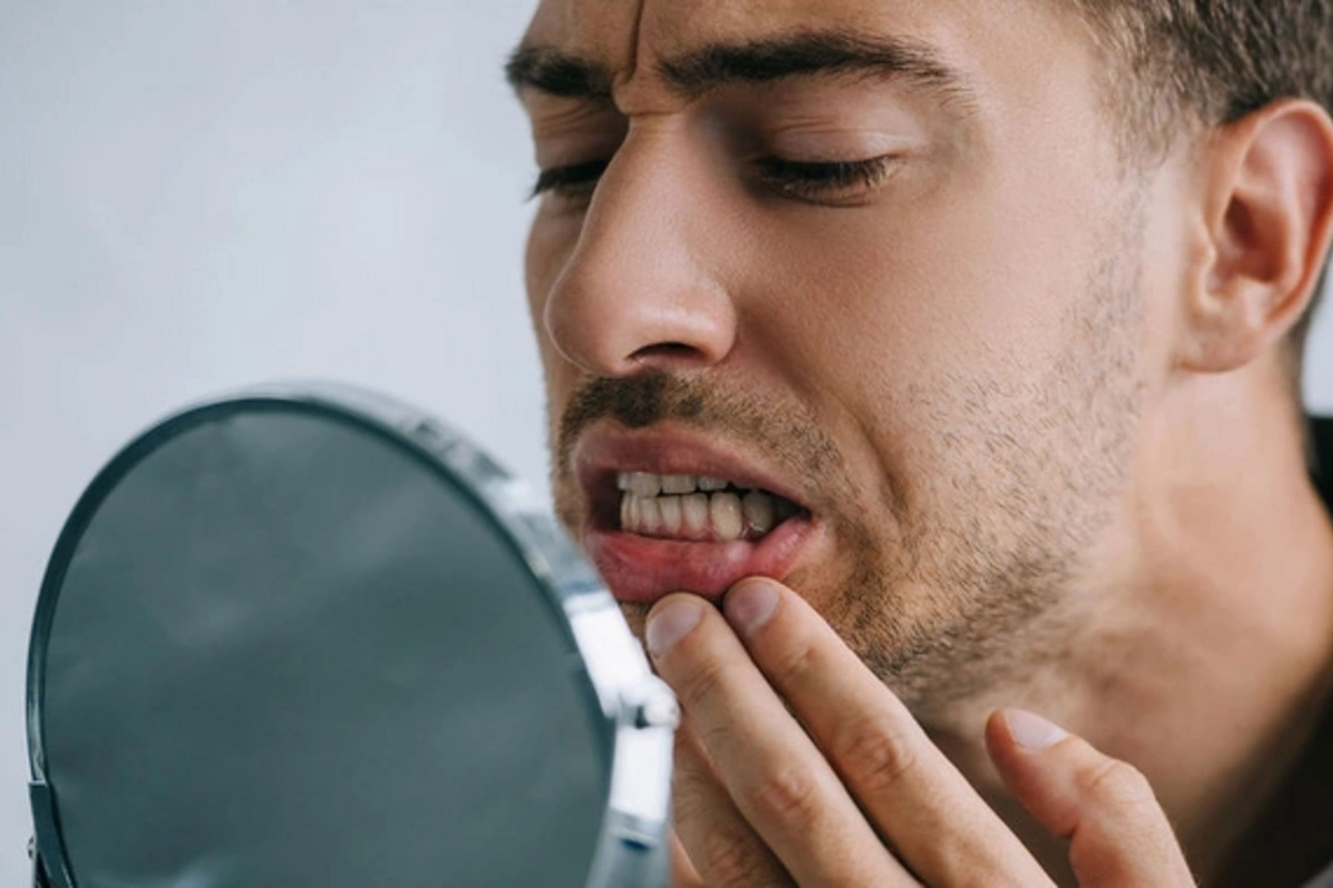 Products that deplete tooth enamel of minerals have been identified