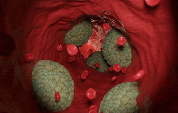 Unexpected factor increasing risk of early death revealed## Conversation