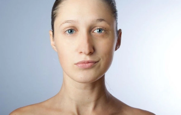 Scientists have revealed an unexpected cause of sudden facial asymmetry