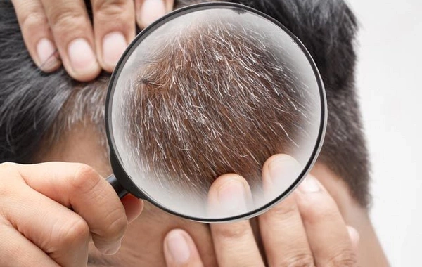 Why gray hair appears early: shocking facts you should know
