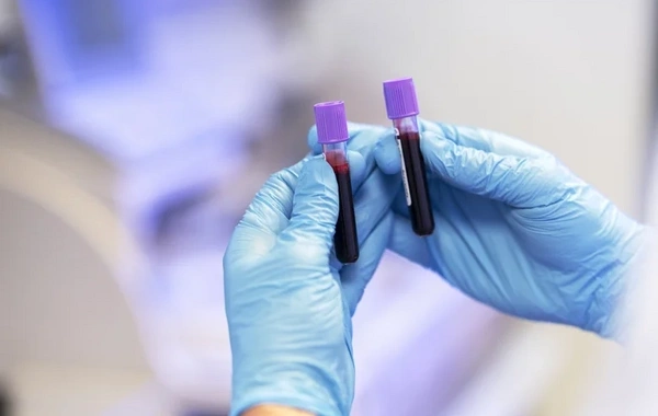 Развенчан распространенный миф о результатах общего анализа крови