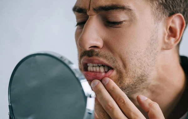 Microcracks in teeth: unexpected cause revealed