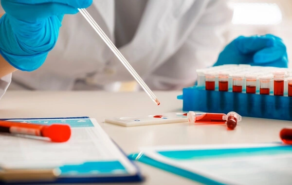 Раскрыт фактор, ускоряющий старение мужчин среднего возраста