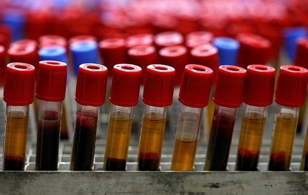 Обнаружен метод точного прогнозирования риска преждевременной смерти