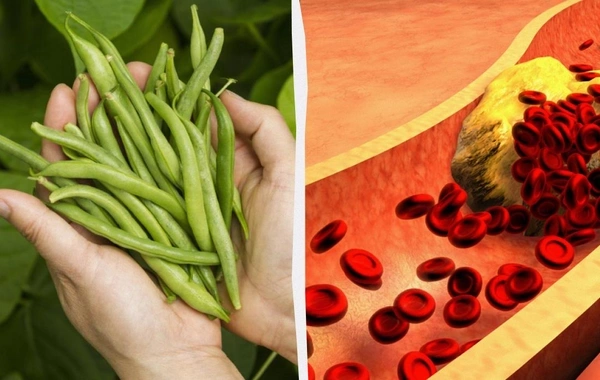 Nutritionist named the best carbohydrate that will reduce cholesterol levels in the bloodThe nutrition specialist revealed the secret to fighting elevated cholesterol, pointing to one of the most beneficial carbohydrates capable of significantly improving