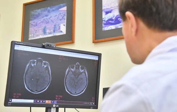 Hidden cause of rare childhood stroke revealed