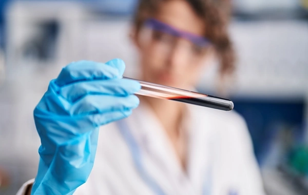  Создан революционный препарат для омоложения клеток крови