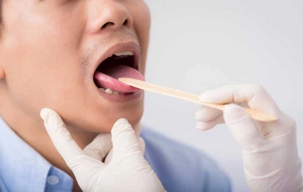 What the color of your tongue can reveal: unexpected signals from your body