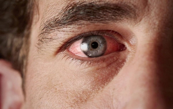 How to recognize health problems by looking at the eyes?