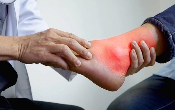 The drink that increases the risk of gout has been namedScientists have identified a drink that can significantly increase the risk of developing gout - a painful inflammatory joint disease. According to research, excessive consumption of this common drin
