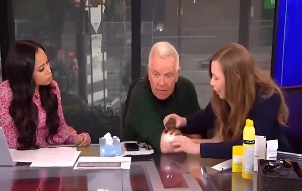 TV presenter diagnosed with skin cancer during live broadcast