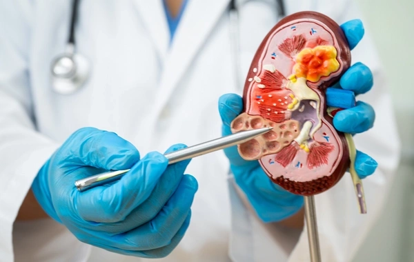 Scientists named the age after which kidneys begin to fail