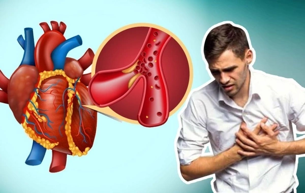  Мужчинам объяснили причины повышенного риска остановки сердцаСпециалисты раскрыли, почему представители сильного пола подвержены большей опасности внезапной сердечной недостаточности. Новое исследование проливает свет на факторы, которые делают мужчин бо