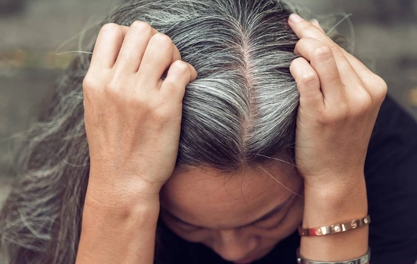 Revealed main causes of premature graying