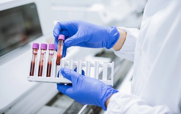 Учёные: риск рака крови на треть ниже у некоторых людей