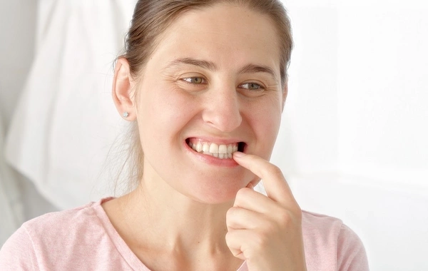 Amazing facts about dental plaque that will surprise you