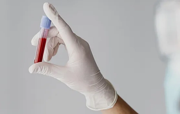 Just one test will tell you about the condition of your thyroid after 50